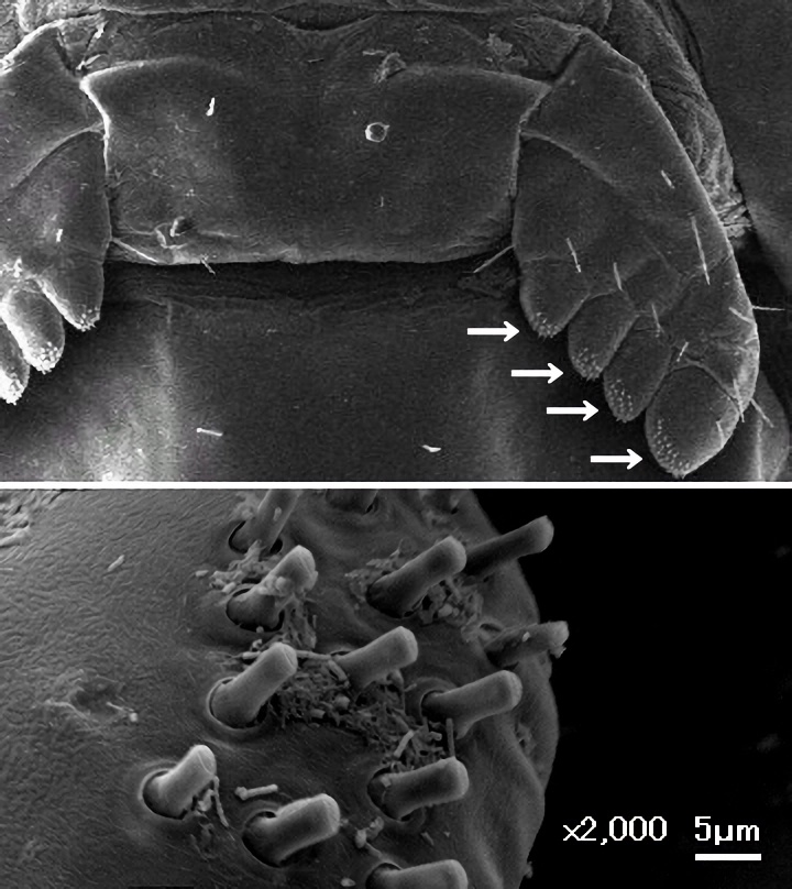Scorpion pectines and peg sensilla